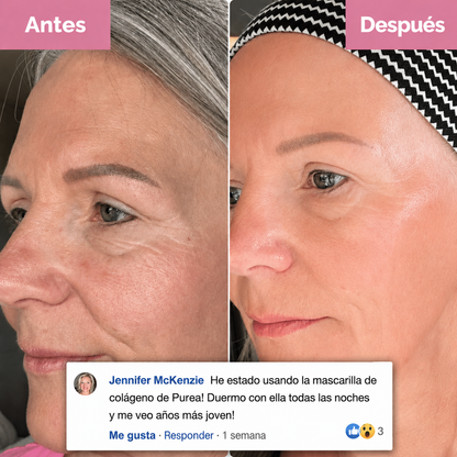 Mascarilla de colágeno